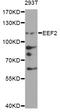 Eukaryotic Translation Elongation Factor 2 antibody, A0099, ABclonal Technology, Western Blot image 