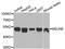 NOP2/Sun RNA Methyltransferase 6 antibody, A7205, ABclonal Technology, Western Blot image 