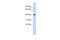 Poly(ADP-Ribose) Polymerase Family Member 11 antibody, ARP33767_P050, Aviva Systems Biology, Western Blot image 