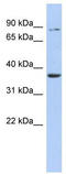 Heparan Sulfate-Glucosamine 3-Sulfotransferase 1 antibody, TA332073, Origene, Western Blot image 