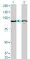 Adenosine Monophosphate Deaminase 2 antibody, LS-C139411, Lifespan Biosciences, Western Blot image 