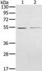 N-Myristoyltransferase 2 antibody, PA5-50466, Invitrogen Antibodies, Western Blot image 