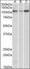 ATPase Sarcoplasmic/Endoplasmic Reticulum Ca2+ Transporting 2 antibody, orb375431, Biorbyt, Western Blot image 