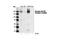 Colony Stimulating Factor 1 Receptor antibody, 3154S, Cell Signaling Technology, Western Blot image 