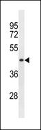 Tripartite Motif-Containing 51 antibody, LS-C156123, Lifespan Biosciences, Western Blot image 