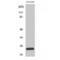 BCL2L2-PABPN1 Readthrough antibody, LS-C382259, Lifespan Biosciences, Western Blot image 