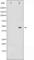 Mitogen-Activated Protein Kinase Kinase 2 antibody, abx011135, Abbexa, Western Blot image 