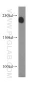 Latent Transforming Growth Factor Beta Binding Protein 2 antibody, 17708-1-AP, Proteintech Group, Western Blot image 