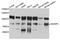 Non-SMC Condensin I Complex Subunit H antibody, orb373244, Biorbyt, Western Blot image 