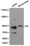 Androgen Receptor antibody, LS-C193041, Lifespan Biosciences, Western Blot image 