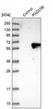 RAD23 Homolog B, Nucleotide Excision Repair Protein antibody, PA5-56236, Invitrogen Antibodies, Western Blot image 