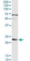 Fibrinogen Alpha Chain antibody, H00002243-M01, Novus Biologicals, Immunoprecipitation image 