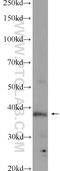 Transcriptional Adaptor 1 antibody, 20337-1-AP, Proteintech Group, Enzyme Linked Immunosorbent Assay image 