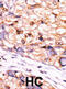 CTD Small Phosphatase 1 antibody, abx033964, Abbexa, Immunohistochemistry paraffin image 