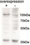 Alanyl-TRNA Synthetase 2, Mitochondrial antibody, LS-C154988, Lifespan Biosciences, Western Blot image 