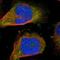 S100 Calcium Binding Protein A7 antibody, NBP1-87205, Novus Biologicals, Immunocytochemistry image 