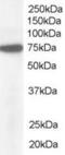 Nucleoporin 85 antibody, EB06201, Everest Biotech, Western Blot image 