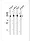 Cyclin Dependent Kinase Like 3 antibody, M12184, Boster Biological Technology, Western Blot image 