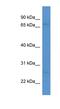 Maestro antibody, NBP1-79844, Novus Biologicals, Western Blot image 