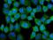 Chaperonin Containing TCP1 Subunit 3 antibody, M05920, Boster Biological Technology, Immunofluorescence image 