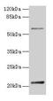 Dual Specificity Phosphatase 13 antibody, CSB-PA734923HA01HU, Cusabio, Western Blot image 