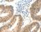 Signal-Induced Proliferation-Associated 1 antibody, LS-C406036, Lifespan Biosciences, Immunohistochemistry paraffin image 