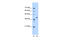 Enoyl-CoA Hydratase Domain Containing 3 antibody, 30-472, ProSci, Western Blot image 