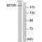 BCL6 Corepressor antibody, PA5-49904, Invitrogen Antibodies, Western Blot image 