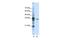 Exosome Component 3 antibody, PA5-41718, Invitrogen Antibodies, Western Blot image 
