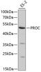 Protein C, Inactivator Of Coagulation Factors Va And VIIIa antibody, GTX55759, GeneTex, Western Blot image 