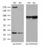 Sperm Associated Antigen 5 antibody, M07062, Boster Biological Technology, Western Blot image 
