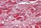 NOVA Alternative Splicing Regulator 1 antibody, NBP1-00221, Novus Biologicals, Immunohistochemistry paraffin image 