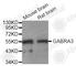 Gamma-Aminobutyric Acid Type A Receptor Alpha3 Subunit antibody, A7522, ABclonal Technology, Western Blot image 