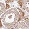 T-cell leukemia/lymphoma protein 1B antibody, NBP2-47608, Novus Biologicals, Immunohistochemistry frozen image 