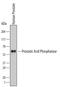 Acid Phosphatase, Prostate antibody, MAB6240, R&D Systems, Western Blot image 