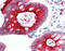 Carcinoembryonic Antigen Related Cell Adhesion Molecule 3 antibody, 51-826, ProSci, Immunohistochemistry paraffin image 