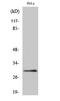 Eukaryotic Translation Initiation Factor 3 Subunit K antibody, A07789-1, Boster Biological Technology, Western Blot image 