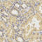 SMYD Family Member 5 antibody, 22-047, ProSci, Immunohistochemistry paraffin image 