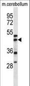 Alpha-centractin antibody, LS-C156008, Lifespan Biosciences, Western Blot image 