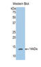 Phosphoglucomutase 5 antibody, LS-C298485, Lifespan Biosciences, Western Blot image 