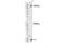 ACK1 antibody, 3138S, Cell Signaling Technology, Western Blot image 