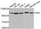 Hexokinase 3 antibody, STJ110726, St John