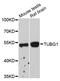 Tubulin Gamma 1 antibody, STJ27971, St John