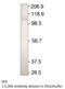 Adenylate Cyclase 2 antibody, MBS540198, MyBioSource, Western Blot image 