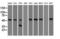 Alpha-1-antitrypsin antibody, LS-C800103, Lifespan Biosciences, Western Blot image 