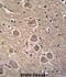 Tumor Protein P53 Inducible Nuclear Protein 1 antibody, abx026416, Abbexa, Immunohistochemistry frozen image 