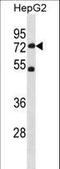 SET Domain Containing 3, Actin Histidine Methyltransferase antibody, LS-C156052, Lifespan Biosciences, Western Blot image 