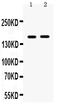 TBC1 Domain Family Member 4 antibody, PB9825, Boster Biological Technology, Western Blot image 
