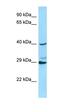 RAB3C, Member RAS Oncogene Family antibody, orb331275, Biorbyt, Western Blot image 