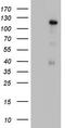 GLI Family Zinc Finger 1 antibody, LS-C789984, Lifespan Biosciences, Western Blot image 